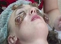 Народная медицина Кожа